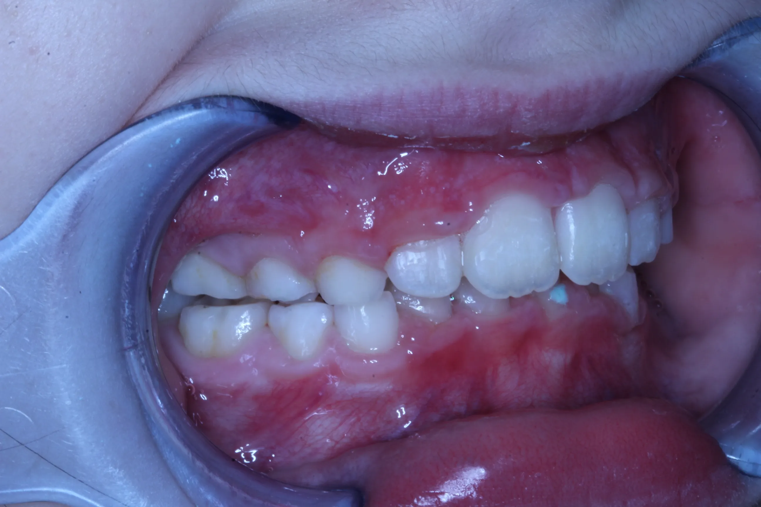 smile-gallery gallery